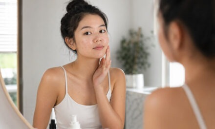 Cum scapi de coșuri și îți recapeți încrederea în tenul tău