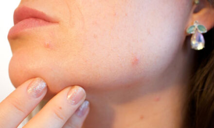 Solutii pentru a scapa de cosuri