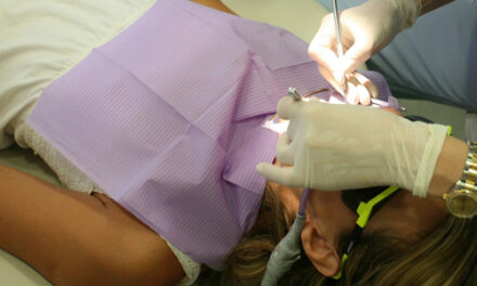 Consumul de alcool poate cauza parodontoza