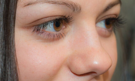 Posibile cauze ale slabirii vederii