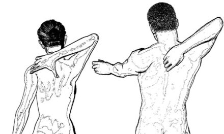 Remedii pentru spondiloza